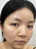 川廿制藥熊果苷乳膏醫(yī)用臉部凝膠精華美白淡斑提亮去黃改善暗沉膚色黑色素 曬單實(shí)拍圖