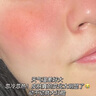 焦博士日本曬后修復(fù)面膜修復(fù)敏感皮膚屏障受損泛紅醫(yī)美用防曬傷急救白 曬單實(shí)拍圖
