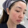 Andwarm原裝進口曬后修復(fù)凝膠女男士兒童面部肌膚膏臉曬傷修復(fù)補水蘆薈膠 100ml【緊急舒緩修護】 曬單實拍圖