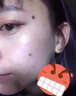 一美奐子點痣膏疤痕修復雀斑祛斑點斑專用非藥去痣點痣膏點疣水官方正品 一盒裝【點痣膏+修復液套裝】 曬單實拍圖
