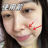 秀瑟祛皺抗皺精華液淡化細(xì)紋去皺紋魚尾紋祛法令紋眼紋4D生物酶注氧液 1瓶裝【日常維穩(wěn)】 曬單實(shí)拍圖
