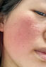 Newliann醫(yī)用械字號洗面奶狀潔面乳控油祛痘除螨蟲去黑頭男士女士修復(fù)屏障 曬單實(shí)拍圖