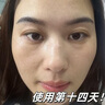 百靈鳥377美白祛斑霜祛斑美白淡化黑色素去雀斑老年黃褐斑男女士專用 曬單實(shí)拍圖