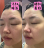 維特絲（vetes）377面膜美白補(bǔ)水淡斑提亮膚色女男士抗干皺緊補(bǔ)水致面膜榜單第1名 【專研377&國貨之光】20片 曬單實(shí)拍圖