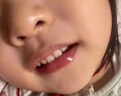 巴貝奇  BABBAGE防咬下嘴唇矯正神器糾正寶寶兒童吸嘴唇張嘴呼吸牙齒地包天矯正器 兒童初期 【偏軟】輕微咬嘴唇 人體工學(xué)設(shè)計(jì) 曬單實(shí)拍圖