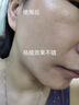 儒意（RUYI）水楊酸面膜20片祛痘淡痘印果酸控油清潔收縮毛孔女男士補(bǔ)水青少年 曬單實(shí)拍圖