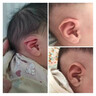其他耳廓矯正器寶寶耳朵矯糾正器嬰兒耳畸形新生兒垂耳招風(fēng)耳膠帶塑形 一個(gè)三抓耳夾送膠帶和教程 曬單實(shí)拍圖