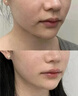 維特絲面膜抗皺緊致抗衰老補(bǔ)水淡斑提亮膚色祛黃改善暗沉男女士 曬單實(shí)拍圖