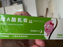尤維佳 維A酸乳膏 0.1%*25g 維a酸軟膏 維a酸軟膏可搭維e尿素乳霜積雪苷祛痘膏痤瘡去閉口粉刺黑色素黑頭改善雞皮膚青春痘丘疹膿皰暗瘡痘痘藥膏祛痘 曬單實(shí)拍圖