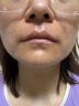 克林霉素甲硝唑搽劑臉上痘痘消炎藥祛痘藥膏醫(yī)用祛痘消炎痤瘡硬疙瘩專用藥青少年粉刺膿皰痤瘡硬疙瘩皮膚用藥 2盒【痘痘粉刺痤瘡專用藥】藥師力薦 臉上反復(fù)冒痘-額頭長痘痘痤瘡粉刺硬疙瘩 曬單實拍圖