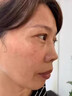 東田日本進口老年斑的藥美白祛斑第1名專用臉部手背祛斑霜100%特俲藥 一盒【體驗款】 曬單實拍圖