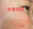 澀岡日本醫(yī)用生長(zhǎng)因子修復(fù)凝膠重組人表皮去黑色素沉淀祛痘印去疤痕 曬單實(shí)拍圖