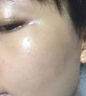 韓方五谷壬二酸祛痘藥膏去痘痘和淡化痘印精華液護膚品青春痘男女學生 曬單實拍圖