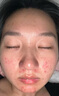 ROTiSS美白淡斑煙酰胺寡肽凍干粉套盒補(bǔ)水保濕痘印痘坑提亮膚色祛斑祛黃 一盒裝 曬單實(shí)拍圖