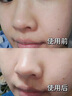 OHBT魚(yú)子醬抗皺面膜10片抗皺緊致抗衰老補水祛黃提亮膚色金榜第1名 曬單實(shí)拍圖