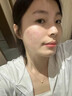 維特絲壬二酸祛痘藥膏去痘痘粉刺閉口收縮毛孔男女煙酰胺水楊酸 曬單實拍圖