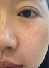 焦博士日本377祛斑霜美白淡化老年黃褐雀斑黑色素熊果苷乳膏去曬男女士 曬單實(shí)拍圖