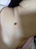 祖郎中去除脖子小肉粒頸部贅皮贅草溫和不留疤祛絲狀尤腋下小猴子去質(zhì)膏 一盒裝（預防護理） 曬單實拍圖