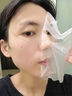 維邦樂醫(yī)用冷敷貼面膜械字號補水皮膚屏障修復(fù)醫(yī)美重組膠原蛋白敷料3盒 曬單實拍圖