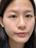 田澤院長毛孔收縮祛痘淡化痘印多效精華液男女毛孔粗大收縮修復 30ml【輕度裝】祛痘修復毛孔 曬單實拍圖