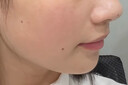 依卡茵凍干粉修復(fù)醫(yī)用藍(lán)銅肽醫(yī)用修復(fù)皮膚屏障祛斑美白祛黃提亮膚色修復(fù) 藍(lán)銅肽凍干粉 一盒 曬單實(shí)拍圖