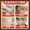 胖東來(lái)美白祛斑霜強(qiáng)效第1名100%淡化老年黃褐雀斑黑色素一夜消專(zhuān)用的藥 2025新科技 男女醫(yī)用【1支裝】 曬單實(shí)拍圖