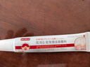 葆元醫(yī)生醫(yī)用皮膚敷料凝膠小肉粒疙瘩去除膏瘊子藥膏 2盒初期裝【輕微癥狀用戶選擇】 曬單實拍圖