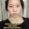 維特絲（vetes）去角質(zhì)面部啫喱控油保濕洗面奶男女士清潔毛孔黑頭閉口溫沒(méi)激素和 【6大專(zhuān)利】果酸去角質(zhì)啫喱200g 曬單實(shí)拍圖
