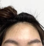 阿達(dá)帕林凝膠改善毛孔粗大醫(yī)用收縮毛孔粗大修復(fù)細(xì)致去黑頭去粉刺祛痘淡化痘印消炎痤瘡專用 1盒裝【非處方藥】 修復(fù)毛孔藥，國藥準(zhǔn)字非處方藥當(dāng)日發(fā)貨放心購買 曬單實(shí)拍圖