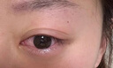杰沐康干眼癥滴眼液眼睛干澀視力模糊眼疲勞治療眼罩瞼板腺堵塞疏通專(zhuān)用 單盒體驗(yàn)裝 曬單實(shí)拍圖