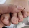 鹽酸阿莫羅芬芬搽劑灰指甲專用藥重度灰指甲專用藥甲癬壞甲空甲亮甲真菌感染鹽酸阿莫羅芬搽劑正品旗艦店 1盒 楚i迪鹽酸阿莫羅芬,乳.膏【灰指甲專用藥 曬單實拍圖