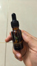 奕森祛痘精華液 無酸去痘淡痕閉口修護皮膚屏障官方店 20ml(單瓶) 曬單實拍圖