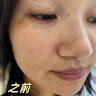 Losoki瑞士進(jìn)口377面膜美白補(bǔ)水淡斑提亮膚色女男士抗皺緊致抗衰老熬夜 曬單實(shí)拍圖