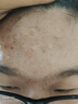 Hi!papa海龜爸爸青少年護(hù)膚套盒祛痘控油洗面奶水乳青春期女孩男孩護(hù)膚品 曬單實(shí)拍圖