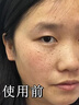 奈皙日本377煙酰胺美白祛斑霜淡化黑色素去雀斑老年黃褐斑面霜男女士 曬單實拍圖