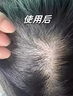 Losoki瑞士進(jìn)口氨基酸洗面奶美白控油祛痘除螨蟲(chóng)去黑頭男女士專用潔面乳 曬單實(shí)拍圖