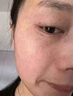 維a酸乳膏去老年斑專用藥一夜i消祛斑點(diǎn)斑專用藥水去老年斑的藥強(qiáng)力去除手部臉部祛斑第一名老人斑專用除斑 1盒【老年斑專用藥】 曬單實(shí)拍圖