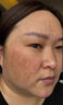 傾齡VC精華液美i白淡斑提亮膚色抗皺緊致提亮去黃淡斑祛斑淡化黑色素 一盒體驗裝 曬單實拍圖
