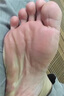 傾姿堂腳氣噴劑止癢脫皮爛腳丫真菌感染去水泡型腳汗腳臭專用噴霧35ML 曬單實(shí)拍圖