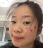 妍膚美白祛斑霜祛斑老年黃褐斑雀斑曬斑男女士專用的去斑去黑色素正品 醫(yī)用液【祛斑液】1盒 20g 【無效秒退】 377+577臉部手背專用霜去老人斑 曬單實(shí)拍圖