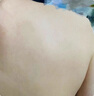 時珍星脂肪瘤專用膏專消皮下多發(fā)性脂肪瘤粒藥監(jiān)備案去除囊腫硬包塊 曬單實拍圖