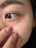日本脂肪粒去除神器眼部專用去脂肪粒眼霜去脂肪粒藥膏汗管瘤克星 【單盒裝 無買贈(zèng)】 曬單實(shí)拍圖