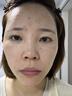 韓尚嬌正品薇旖美三型膠原蛋白4mg凍干粉水光原液自三類(lèi)打械字號十七型 薇旖美三型膠原蛋白眼周凍干粉4mg【1瓶】 曬單實(shí)拍圖