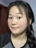 南京同仁堂祛痘膏去痘痘和痘印痘坑修復(fù)男女士改善粉刺閉口30g 曬單實(shí)拍圖