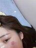 SWEETCHIC醫(yī)用輔助傷口快速愈合促進(jìn)長肉非藥修復(fù)擦傷燙傷褥瘡消殺炎菌噴霧 醫(yī)用創(chuàng)面敷料 30ml新老包裝交替發(fā)貨 曬單實(shí)拍圖