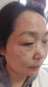 巖井昃弘去斑專用醫(yī)用正品祛斑霜美白淡化黃褐雀斑黑色素老年點(diǎn)斑藥一夜消 3盒特效【醫(yī)美熱銷】99w患者去除 美白祛斑霜 曬單實(shí)拍圖
