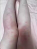 L-CALORIE復(fù)合維生素搭SUSF多維盾素敏凡復(fù)合維生素速斯梵蕁麻疹提升免疫力 一瓶體驗裝 搭多維盾復(fù)合維生素 曬單實拍圖