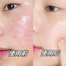 ning進(jìn)口曬后修復(fù)凝膠面部肌膚膏臉曬傷修復(fù)急救補(bǔ)水保濕冰沙霜男女士 曬單實(shí)拍圖