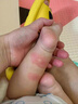 百膚邦防蚊子跳蚤咬蚊蟲(chóng)叮咬止癢膏臭蟲(chóng)螨蟲(chóng)螞蟻咬傷嬰幼兒成人消腫走珠 走珠冰露3支 曬單實(shí)拍圖