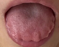 脾胃虛弱濕氣重肝火盛氣血不足 調(diào)理脾胃的中成藥脾胃虛弱中藥調(diào)理去濕氣調(diào)理脾胃參苓健脾胃顆粒脾胃調(diào)理 1盒裝【補(bǔ)脾健胃】5天用量 曬單實(shí)拍圖